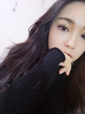 你們看看我做的歐式大雙眼皮怎么樣