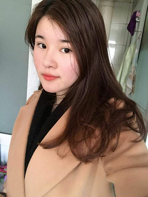 做了詳細部脂肪填充+雙眼皮+假體隆鼻，來看看果如何