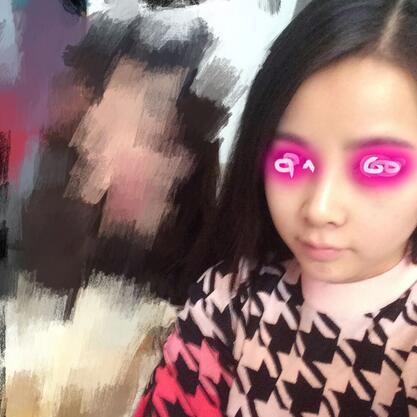 耳軟骨墊鼻尖+隆鼻+鼻翼縮小3個(gè)月了