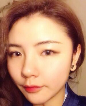 韓式定點雙眼皮前后對比圖，雙眼有神多了