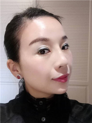 你們來看看我的面部埋埋蛋白線.提升術(shù)恢復情況