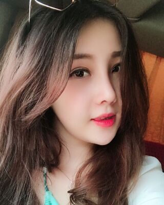 全切雙眼皮+開眼角前后對(duì)比照片圖