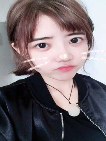 我的隆鼻整形恢復果圖  塌鼻子逆襲記