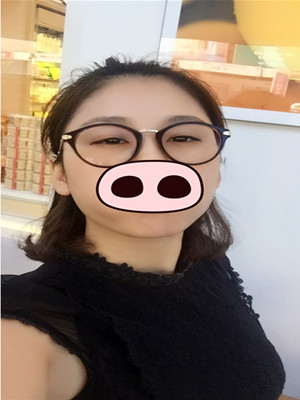 注射瘦臉去眉間紋真實(shí)案例分享——?？诩t妝李科醫(yī)生做的