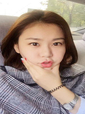 注射瘦臉去眉間紋真實(shí)案例分享——海口紅妝李科醫(yī)生做的