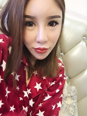 高強(qiáng)度聚焦超聲手術(shù)三個(gè)月的前后恢復(fù)記錄——?？诩t妝李科做的