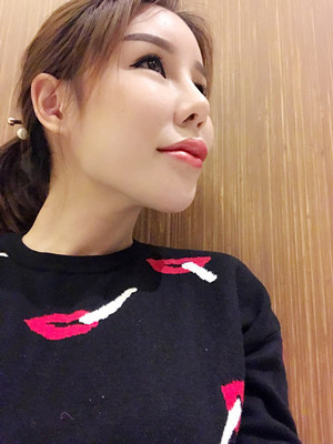 高強(qiáng)度聚焦超聲手術(shù)三個(gè)月的前后恢復(fù)記錄——?？诩t妝李科做的