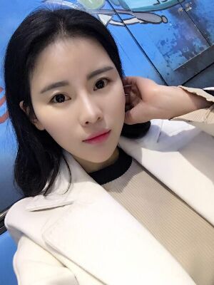 自體脂肪填充全臉經(jīng)歷，臉型超**的