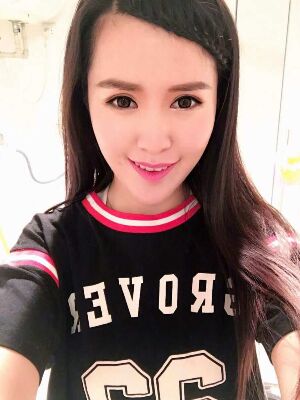 全切雙眼皮修復(fù)恢復(fù)后圖片，寬度較為合適喲