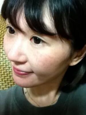 激光去雀斑果好不好，真實(shí)案例告訴你