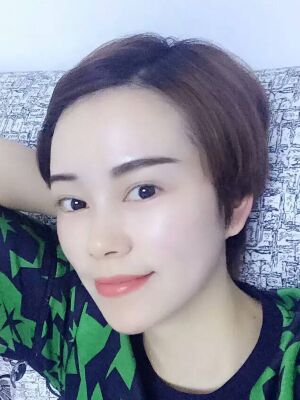 點(diǎn)陣激光祛痘后果對(duì)比圖，皮膚光滑多了