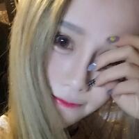 玻尿酸填充臥蠶果對比圖，很滿意