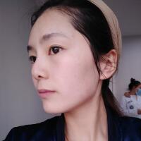 做完光子嫩膚恢復圖片和過程分享，光子嫩膚價格3800元