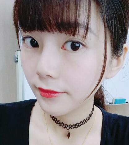 做完光子嫩膚恢復(fù)圖片和過程分享，光子嫩膚價(jià)格3800元