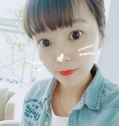 做完光子嫩膚恢復(fù)圖片和過程分享，光子嫩膚價(jià)格3800元