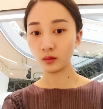 有誰做過激光祛雀斑？個人激光祛雀斑后恢復(fù)日記分享