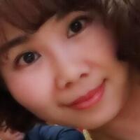 玻尿酸去法令紋后人變年輕了好幾歲