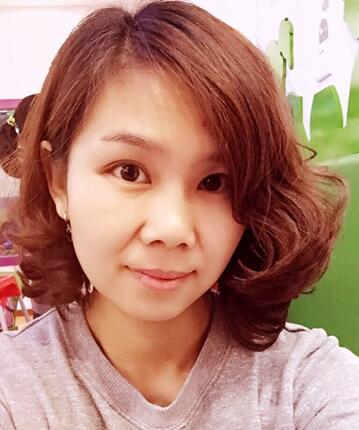 玻尿酸去法令紋后人變年輕了好幾歲