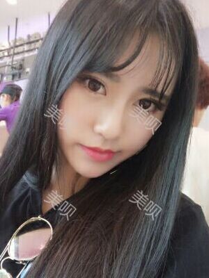 線D隆鼻恢復(fù)過(guò)程圖片，真實(shí)案例照片