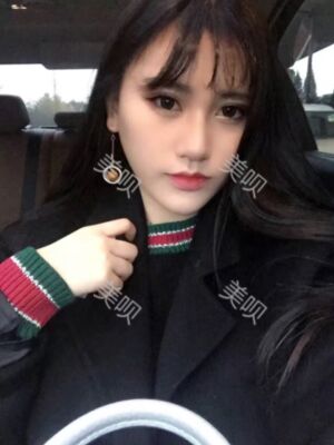 線D隆鼻恢復(fù)過(guò)程圖片，真實(shí)案例照片