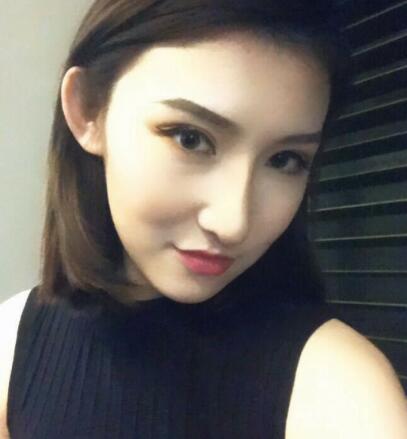 隆鼻失敗修復(fù)后恢復(fù)圖分享，鼻子修復(fù)價格9800元