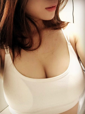 自體脂肪隆胸手術真實案例——邯鄲雅乾侯德勝醫(yī)生做的