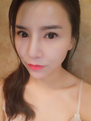 臉部埋埋蛋白線.提升果圖，真實經(jīng)歷分享