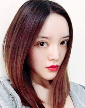 全切雙眼皮+硅膠墊下巴真實(shí)案例對(duì)比圖