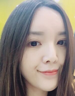 全切雙眼皮+硅膠墊下巴真實(shí)案例對(duì)比圖