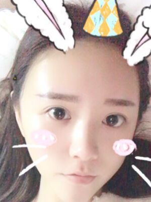 自體脂肪詳細部填充日記，恢復(fù)過程分享