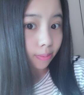 鼻部綜合整形恢復(fù)過程圖分享