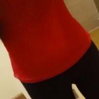 吸脂減肥瘦腰腹不反彈，恢復(fù)過程圖分享