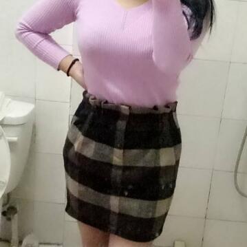 吸脂減肥瘦腰腹不反彈，恢復(fù)過(guò)程圖分享