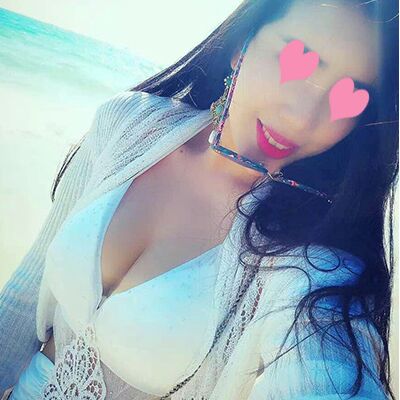 自體脂肪豐胸對比照片，福州愛美爾張勝利做的