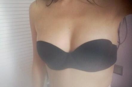 自體脂肪移植隆胸果圖分享，吸脂隆胸價格18800元