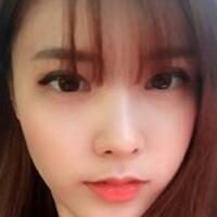 做了割雙眼皮和開內(nèi)眼角雙眼皮多項(xiàng)整形整形手術(shù)，恢復(fù)圖片日志分享