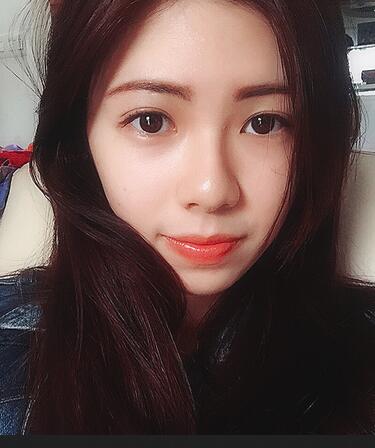 廣州凱美達(dá)微創(chuàng)雙眼皮手術(shù)恢復(fù)期紀(jì)實(shí)