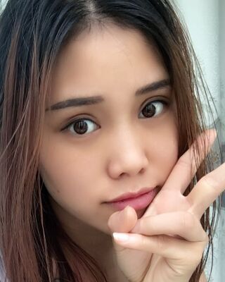 雙眼皮失敗修復果圖，福州愛美爾王召克做的