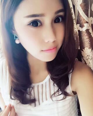 雙眼皮失敗修復果圖，福州愛美爾王召克做的