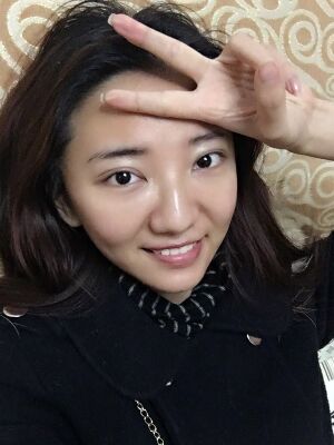 激光祛痘恢復(fù)過程圖，福州愛美爾做的喲