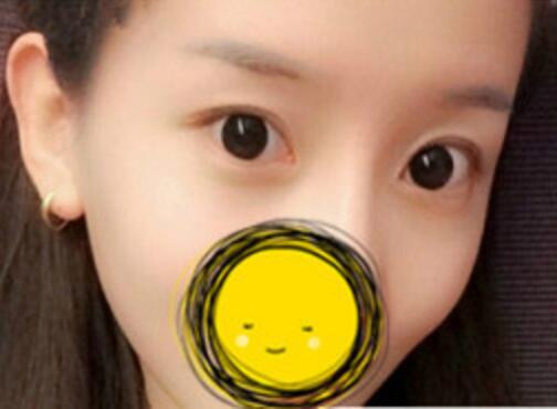 注射瘦臉去抬頭紋果不錯——濟南吉芙美容整形醫(yī)院