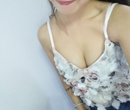 廈門銀河整形自體脂肪隆胸術(shù)后果對比圖