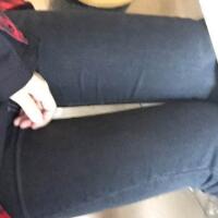 吸脂塑身醫(yī)院推薦歐蘭仁美醫(yī)院，吸脂瘦腿恢復(fù)圖分享