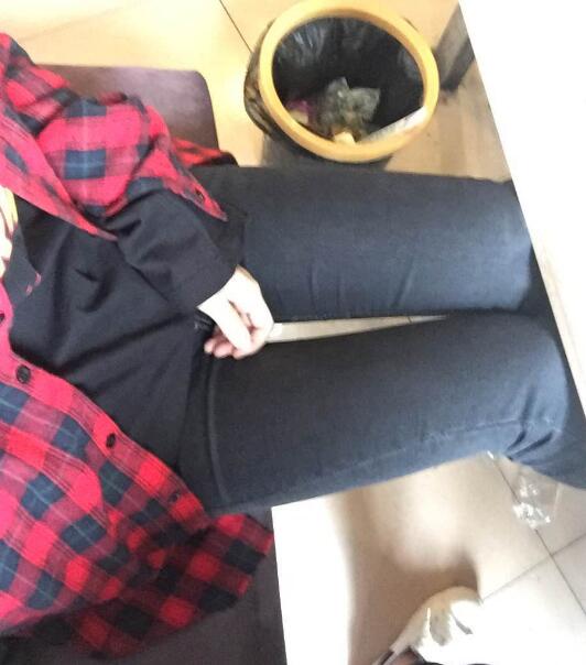 吸脂塑身醫(yī)院推薦歐蘭仁美醫(yī)院，吸脂瘦腿恢復圖分享