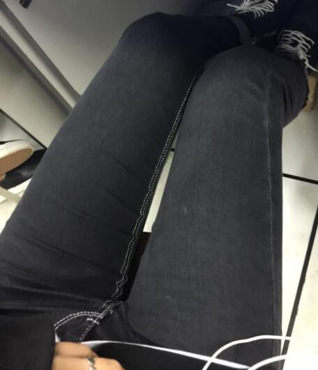 吸脂塑身醫(yī)院推薦歐蘭仁美醫(yī)院，吸脂瘦腿恢復圖分享