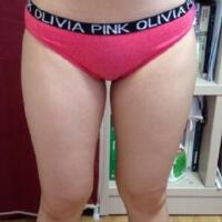 抽脂減肥瘦大腿價格10800元，一個月后恢復(fù)很好
