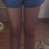 抽脂減肥瘦大腿價格10800元，一個月后恢復(fù)很好