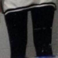 抽脂減肥瘦大腿價格10800元，一個月后恢復(fù)很好