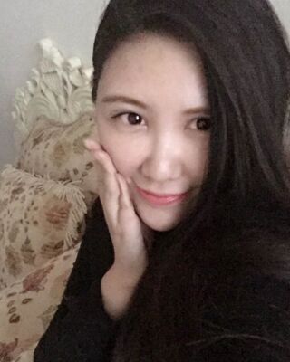 貴陽(yáng)麗都自體脂肪面部填充+雙下巴吸脂恢復(fù)圖片