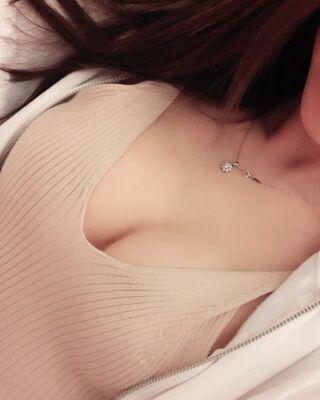 美國曼托假體隆胸手術(shù)果圖，貴陽麗都李觀龍做的